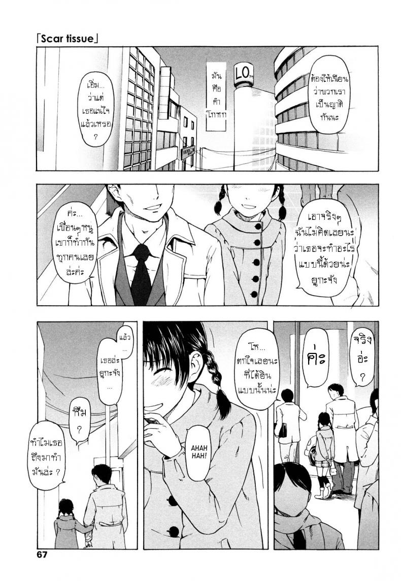 à¸£à¸­à¸¢à¹à¸œà¸¥à¹ƒà¸™à¹ƒà¸ˆ [Onizuka Naoshi] Scar Tissue